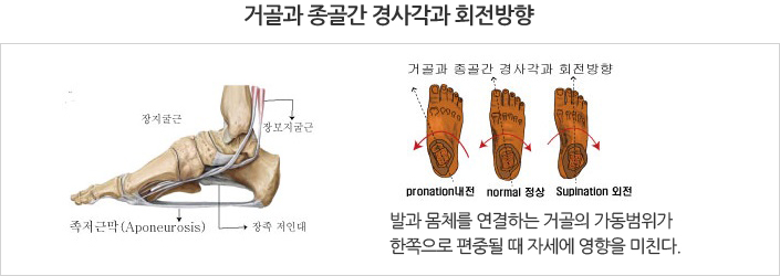 거골과 종골간 경사각과 회전방향 